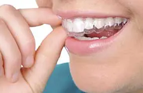 Dental Services | Invisalign Dental Services | Invisalign
